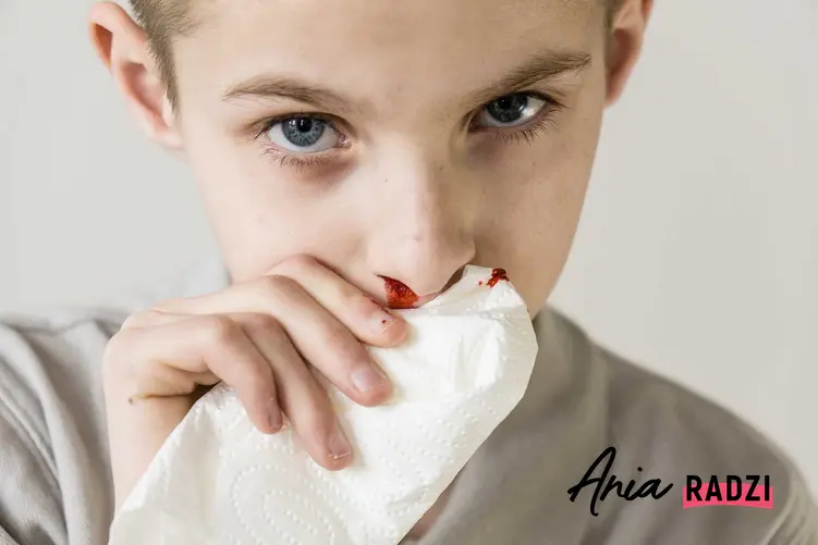Krwawienie z nosa u dziecka oraz przyczyny krwawienia z nosa, w tym częste krwawienie z nosa i jakie jest tego podłoże