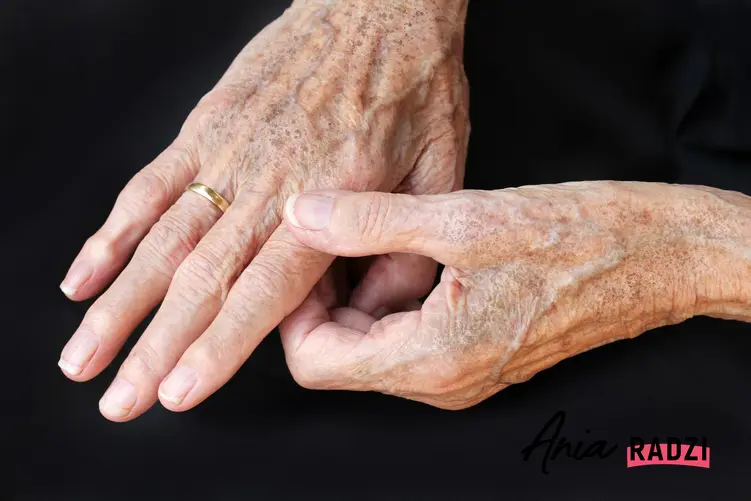 Dłonie starszej osoby na czarnym tle, a także plamy starcze na skórze i ich zwalczanie