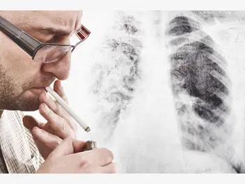 Ilustracja artykułu oczyszczanie płuc po rzuceniu palenia - czy płuca palacza się regenerują?