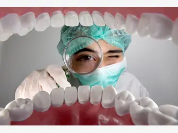 Ilustracja artykułu jak dbać o zęby, aby spowolnić odkładanie kamienia nazębnego?