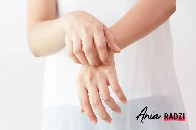 Swędzenie skóry na dłonach, a także najlepsze domowe sposoby na swędzenie skóry krok po kroku