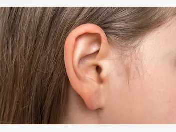 Ilustracja artykułu wągry w uchu - przyczyny, objawy, skuteczne sposoby na pozbycie się ich