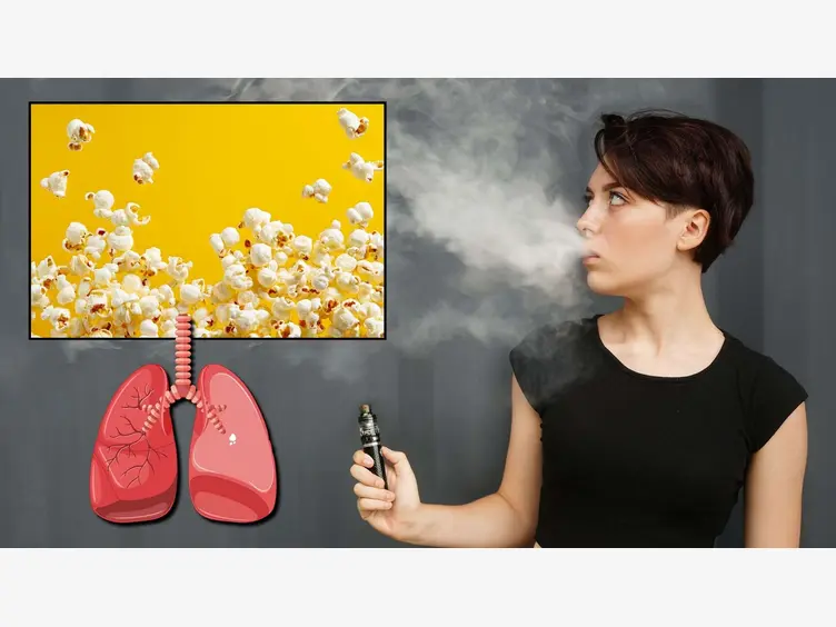 Ilustracja artykułu płuca wyglądają jak popcorn – uwaga na e-papierosy!