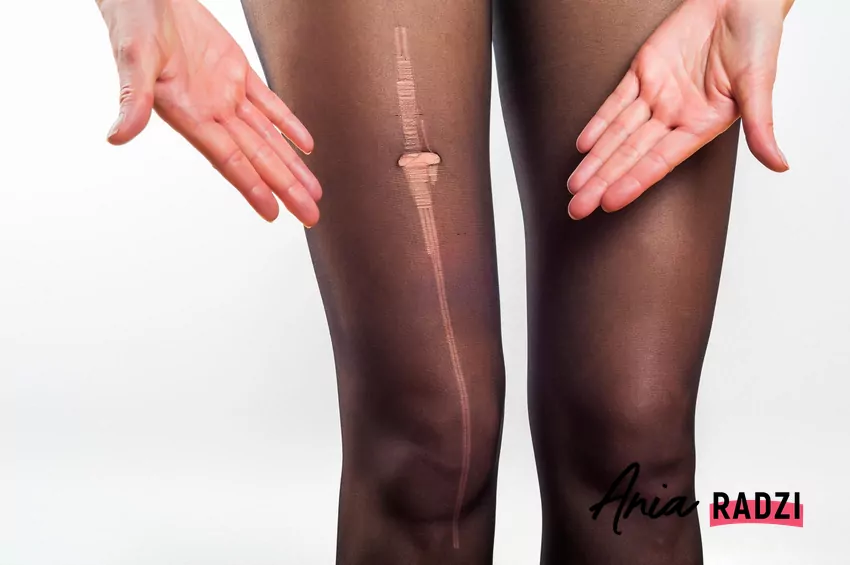 Kobieta w rajstopach