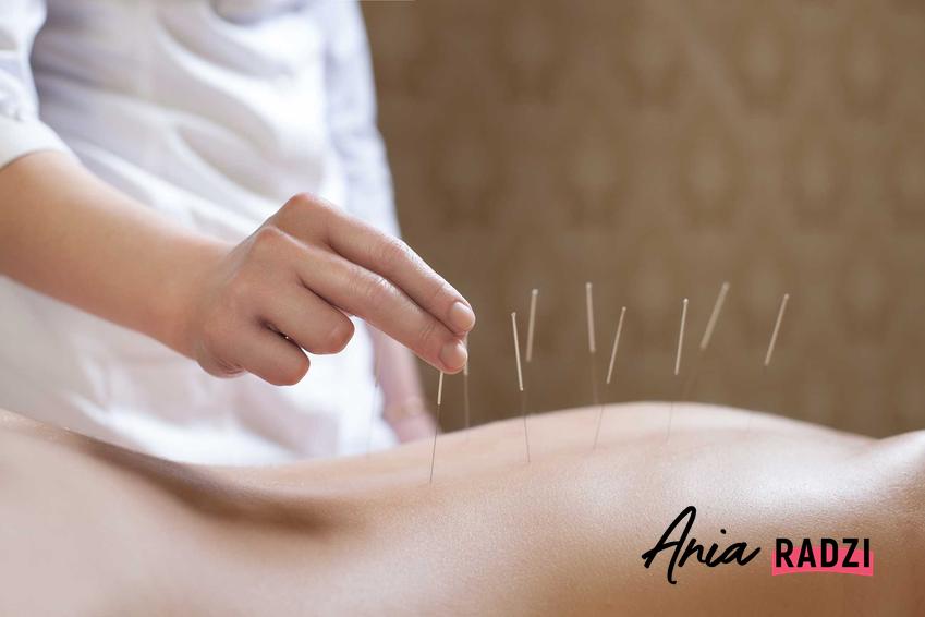 Zabieg akupunktury oraz informacje, na co pomaga akupunktura i leczenie akupunkturą, czyli jej efekty, działanie i zastosowanie