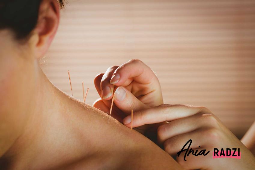 Akupunktura na plecach oraz informacje, na co pomaga akupunktura, czyli jej efekty, działanie i zastosowanie