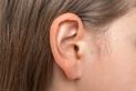 Wągry w uchu - przyczyny, objawy, skuteczne sposoby na pozbycie się ich